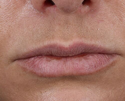Photo before using Plump + Repair Lip Treatment with Hyaluronic Acid