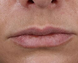 Photo before using Plump + Repair Lip Treatment with Hyaluronic Acid