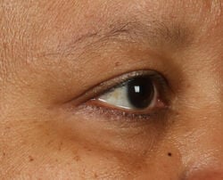 Photo before using Fill + Repair Serum with Hyaluronic Acid