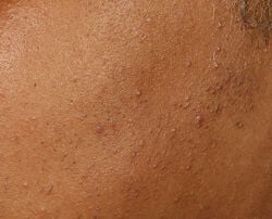 Photo before using Universal Daily Peel