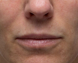 Photo before using Hydrating Modeling Mask