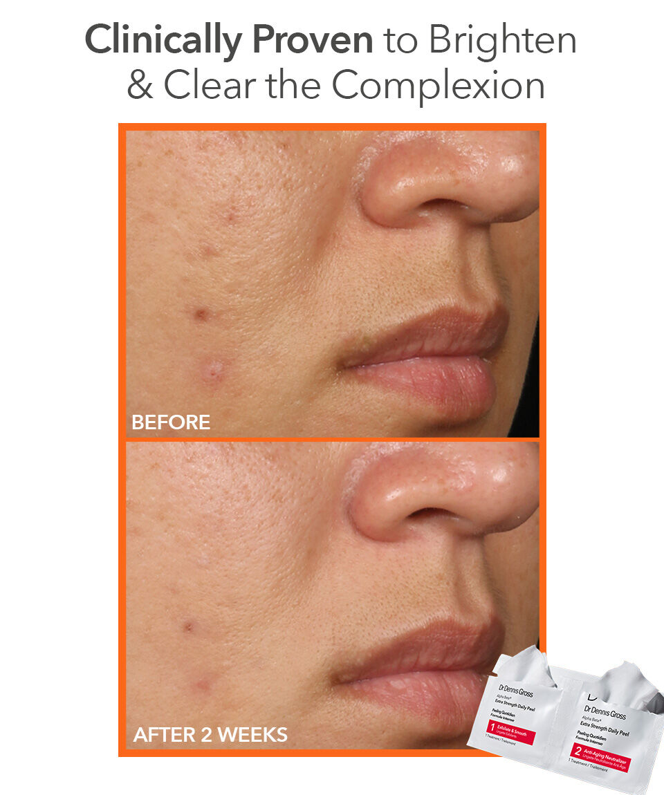 Alpha Beta® Extra Strength Daily Peel | Dr Dennis Gross