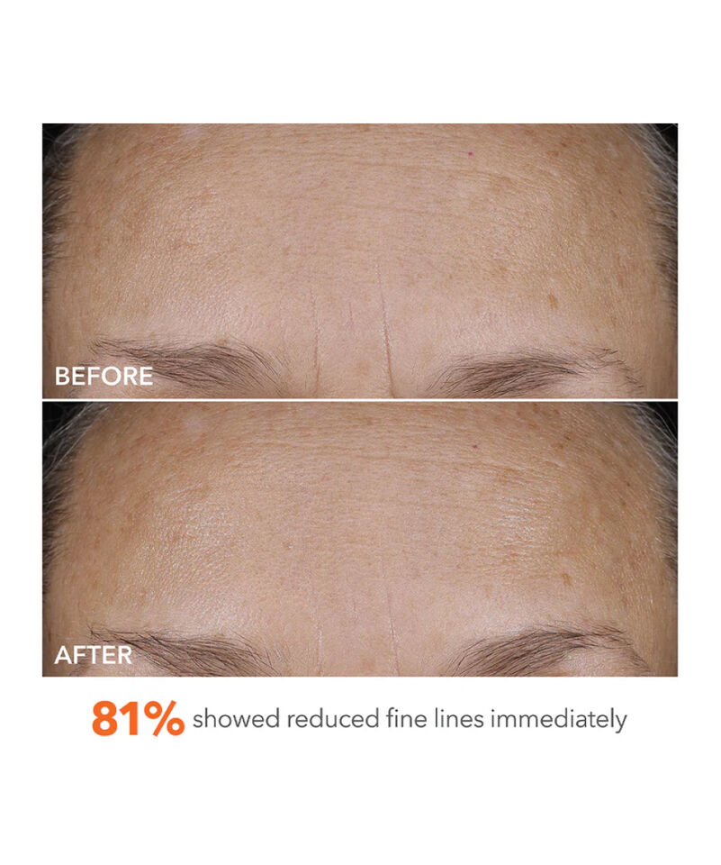 Blur + Repair Moisturizer Cream with Hyaluronic Acid, Image 6 of 8