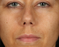 Photo after using Glow Pad Self-Tanner for Face