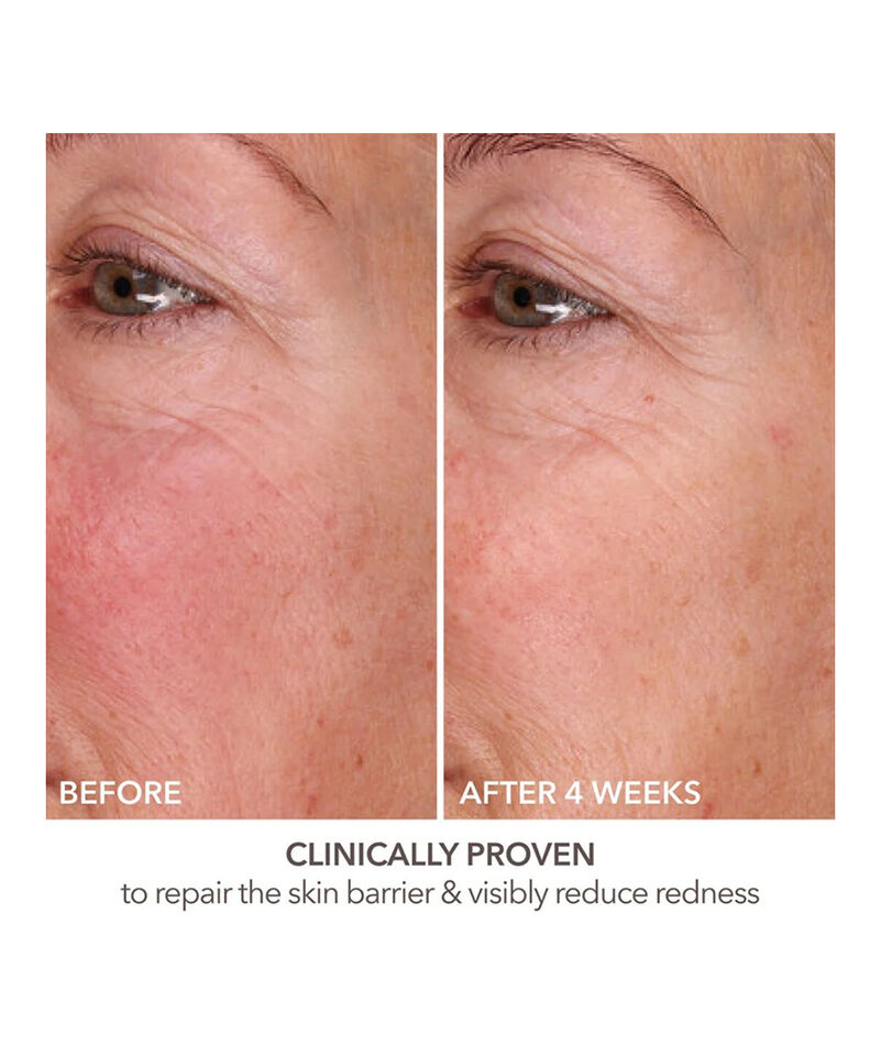 Fill + Repair Serum with Hyaluronic Acid, Image 6 of 8