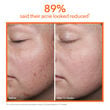 Display Product Shot: Limited Edition FaceWare Pro: Glow in Gold ($455 Value), Image 8 of 11