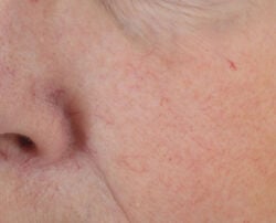 Photo after using Dewy Deep Cream