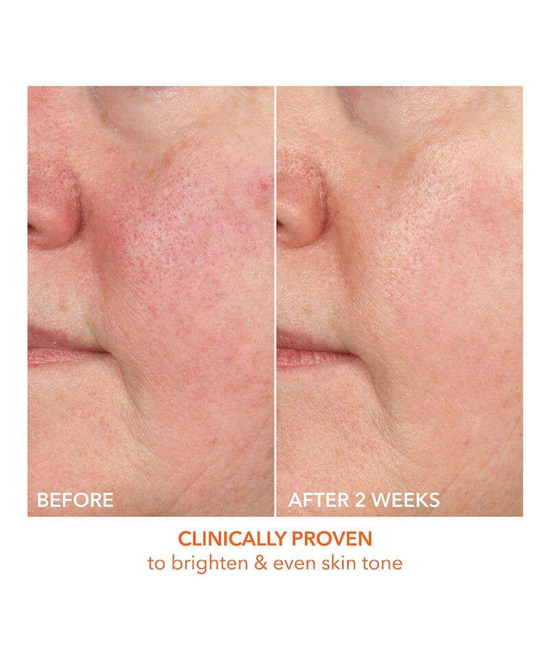15% Vitamin C Firm & Bright Serum, Image 4 of 7