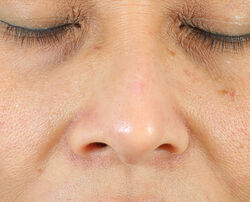 Photo after using Oil-Free Radiant Moisturizer