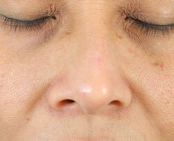 Photo after using Oil-Free Radiant Moisturizer