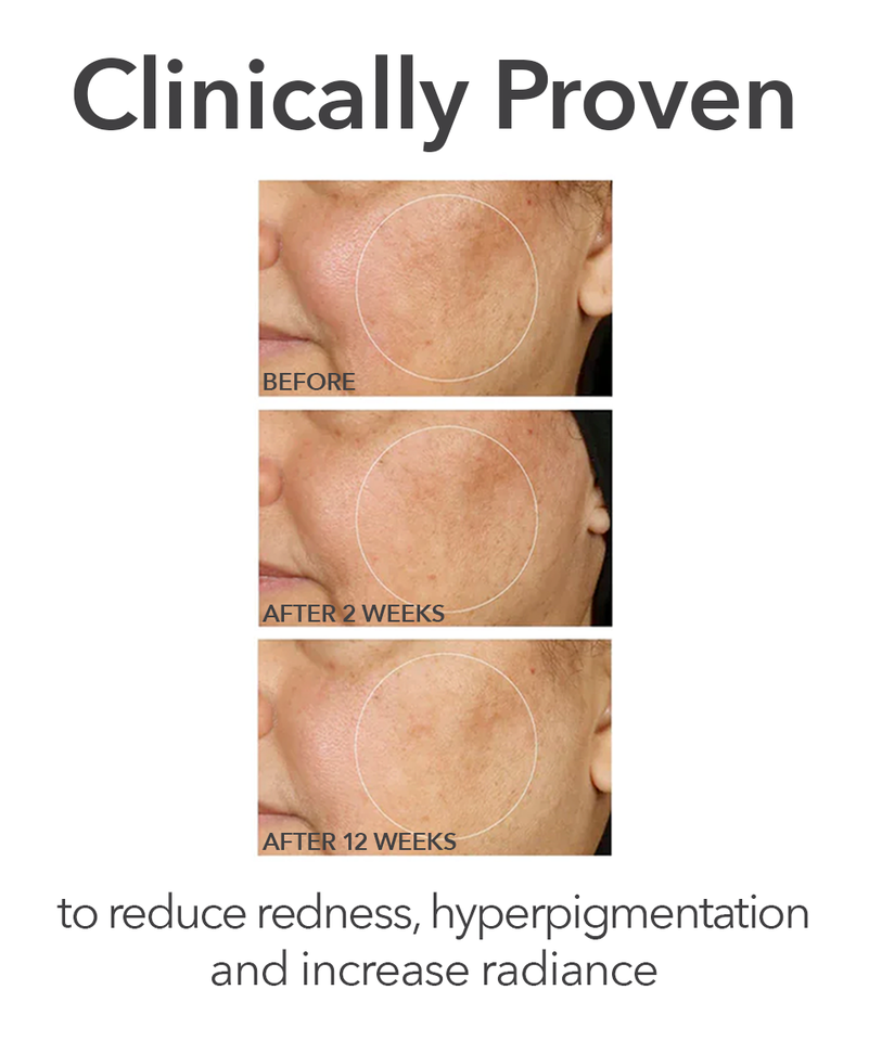 Bring The Clinic Home - DermInfusions™ Discovery Kit, Image 5 of 9