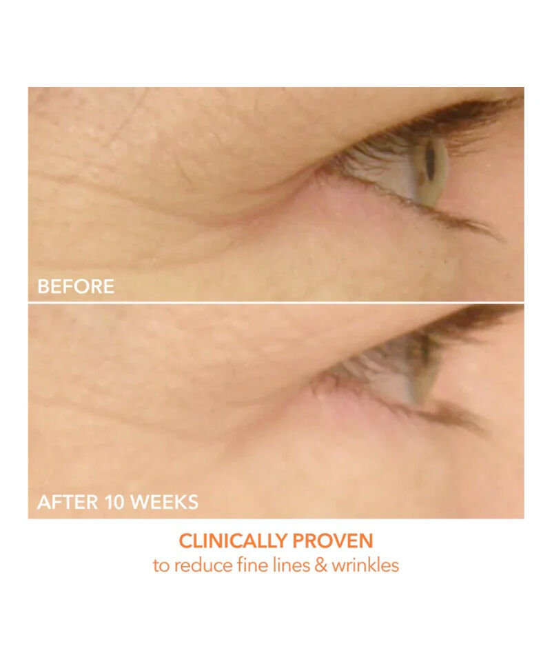 EyeCare Max Pro LED Device, Image 5 of 6