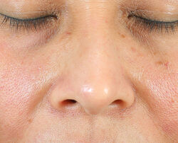 Photo before using Oil-Free Radiant Moisturizer