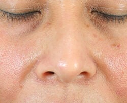 Photo before using Oil-Free Radiant Moisturizer