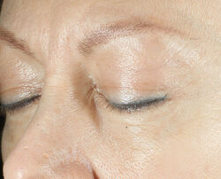 Photo after using Triple Correction Eye Serum