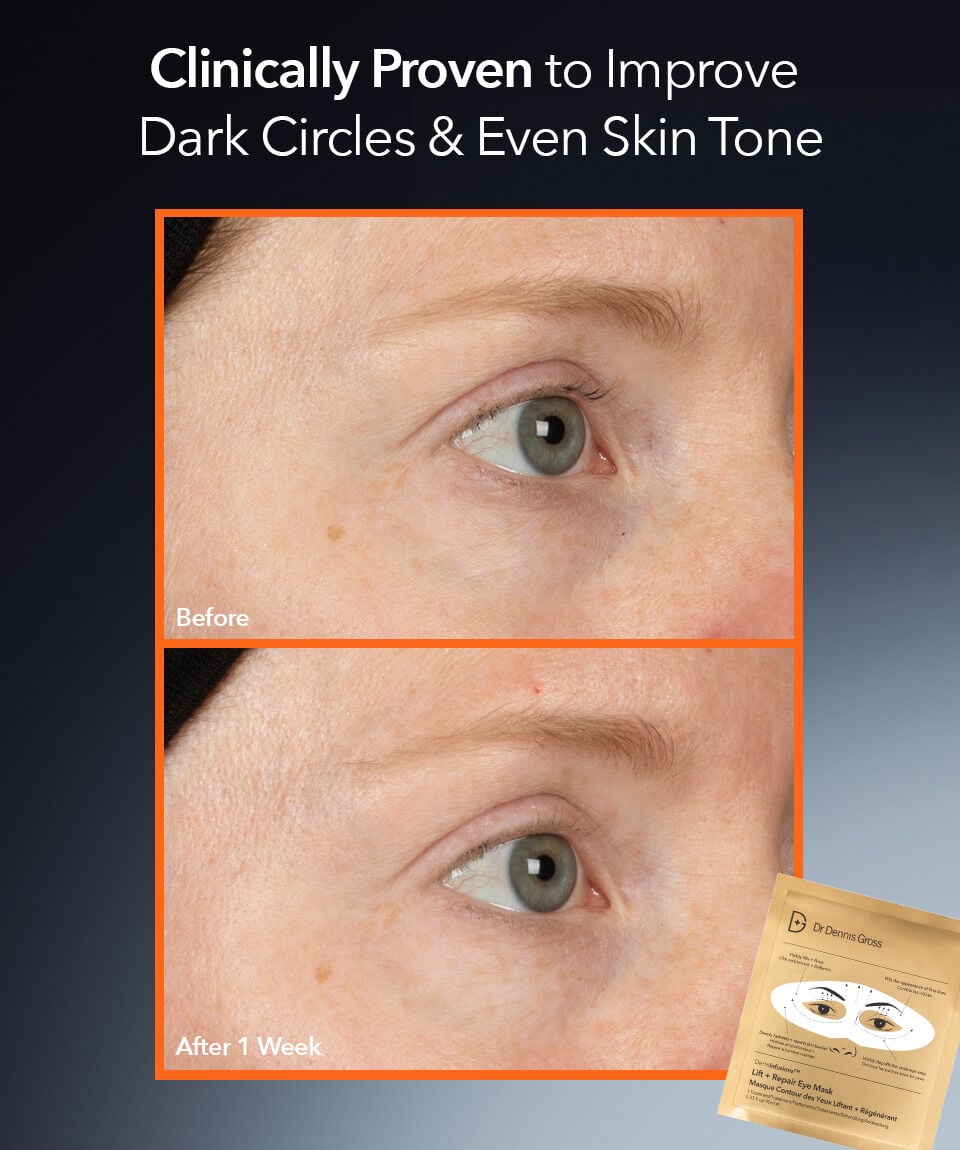 DermInfusions™ Lift + Repair Eye Mask | Dr. Dennis Gross