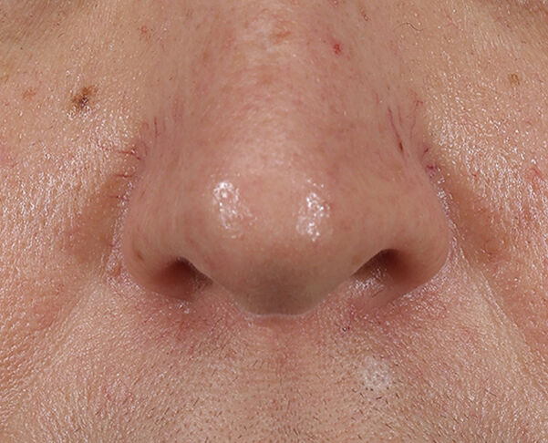 Photo before using Lift + Repair Eye Mask