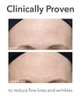 Display Product Shot: Ultra Gentle Daily Peel, Image 5 of 9