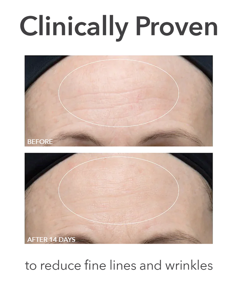 Ultra Gentle Daily Peel, Image 5 of 9