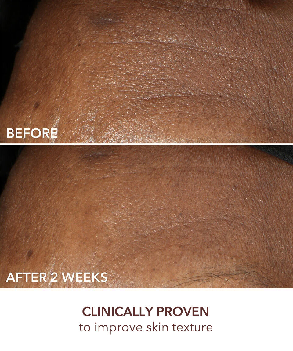 Retinol + Ferulic Anti Aging Wrinkle Cream | Dr. Dennis Gross