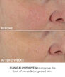 Display Product Shot: Perfectly Dosed Treatments (Universal 0.2%), Image 6 of 11