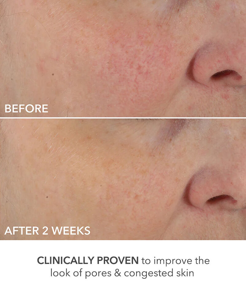 Perfectly Dosed Treatments (Universal 0.2%), Image 6 of 11