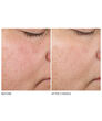 Display Product Shot: Texture Renewal Serum, Image 5 of 6