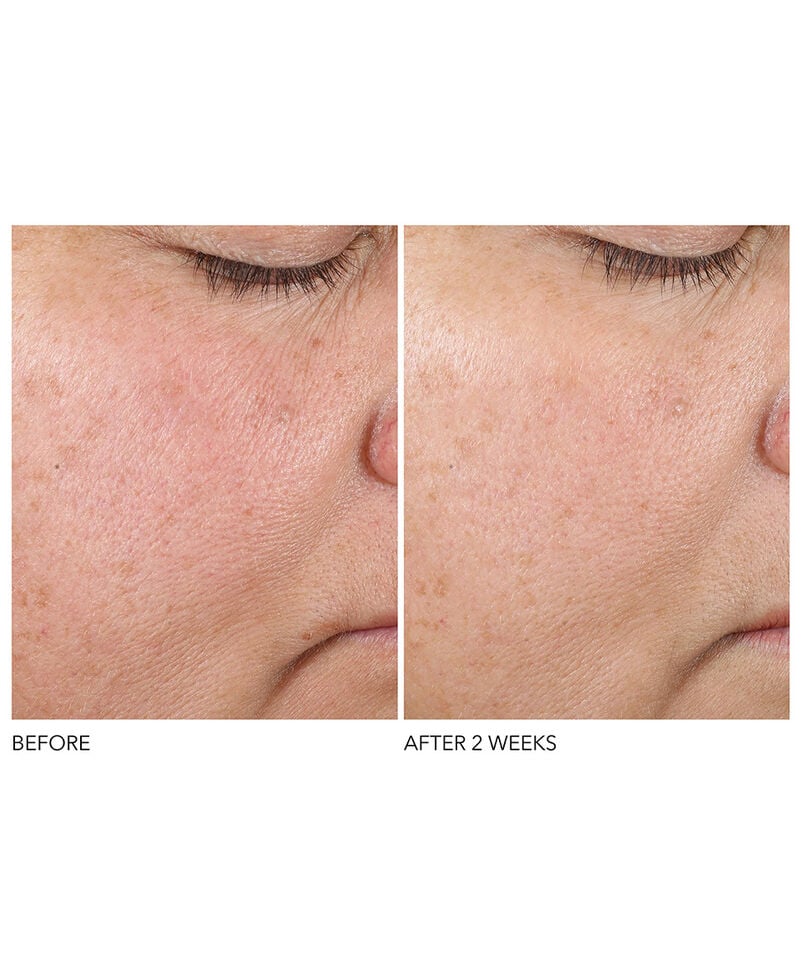 Texture Renewal Serum, Image 5 of 6