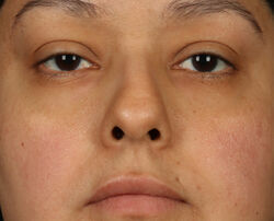 Photo before using pH Balance Replenishing Cream
