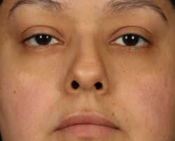 Photo before using pH Balance Replenishing Cream