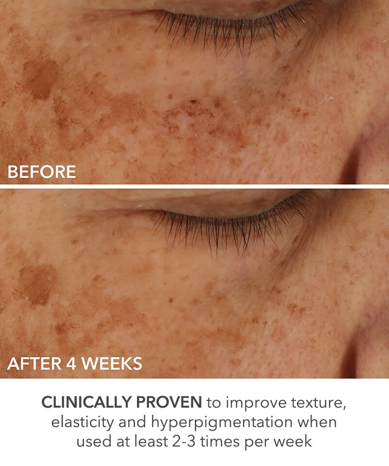 Perfectly Dosed Treatments (Universal 0.2%), Image 7 of 11
