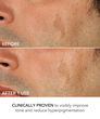 Display Product Shot: Perfectly Dosed Treatment (Extra Strength 0.5%), Image 6 of 11