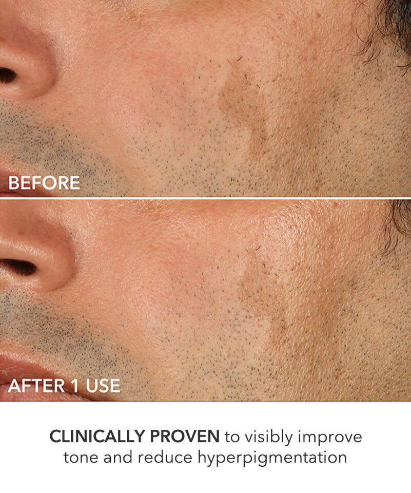 Perfectly Dosed Treatment (Extra Strength 0.5%), Image 6 of 11