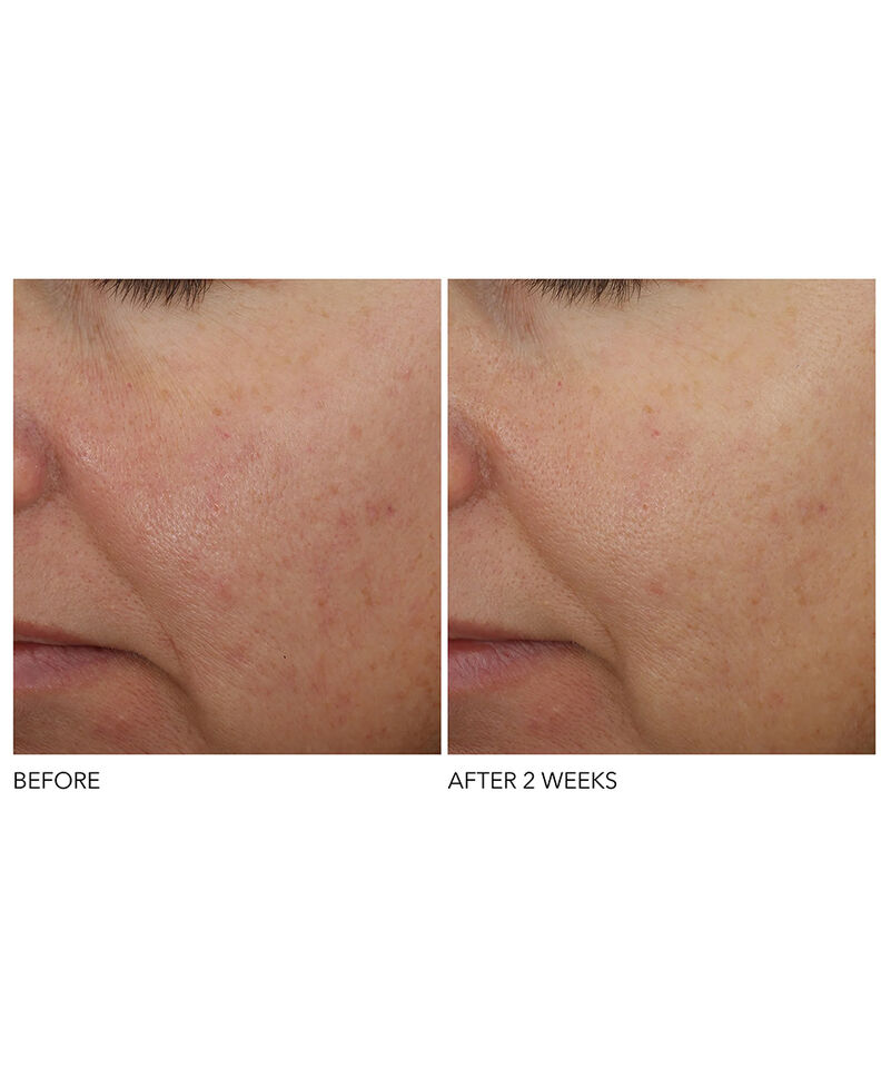 Overnight Wrinkle Serum Treatment, Image 7 of 7