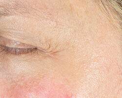 Photo before using Firm & Bright Eye Treatment