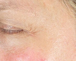 Photo before using Firm & Bright Eye Treatment