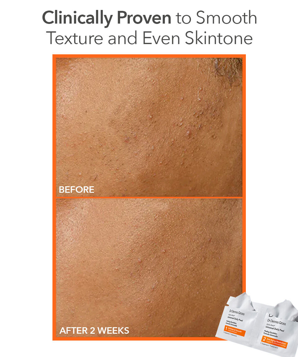 Alpha Beta® Universal Daily Peel | Dr Dennis Gross