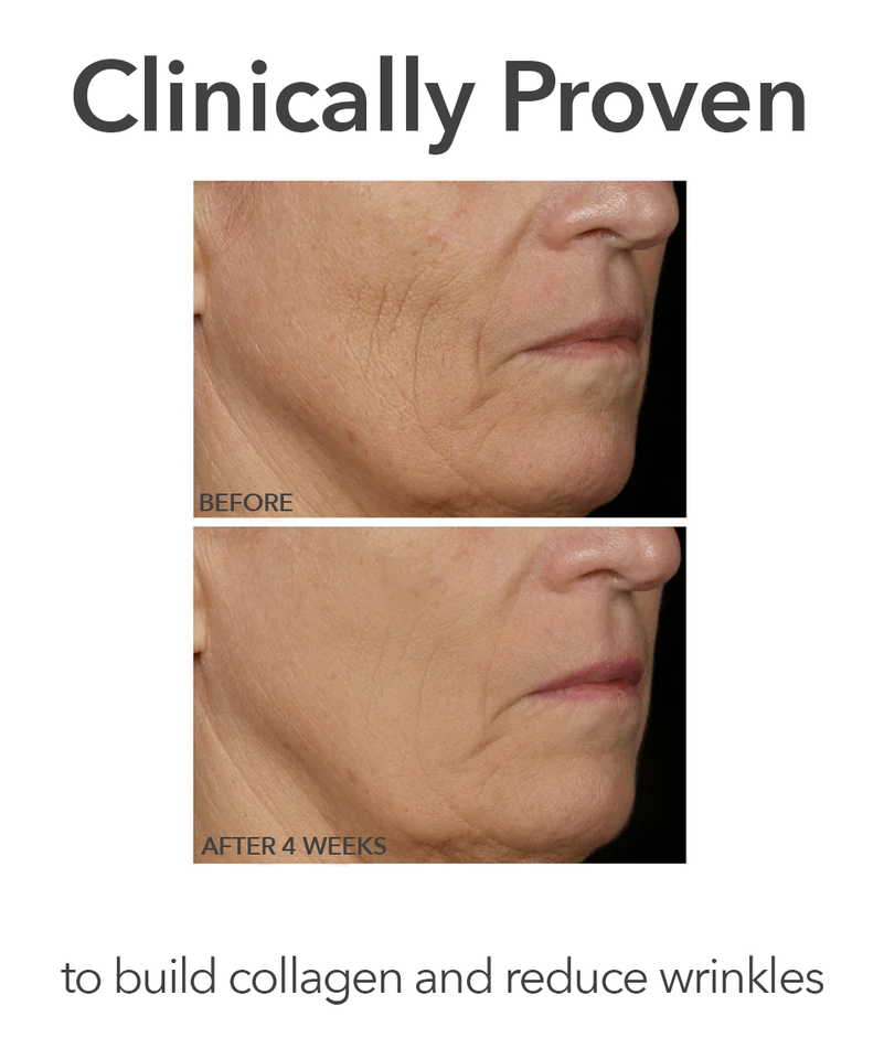 FaceWare Pro LED Device, Image 5 of 10