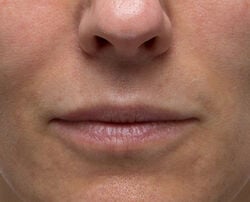 Photo after using Hydrating Modeling Mask