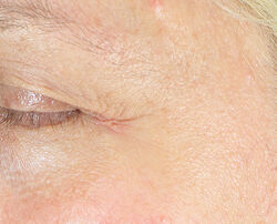 Photo after using Firm & Bright Eye Treatment