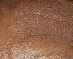 Photo before using Wrinkle Moisturizing Cream
