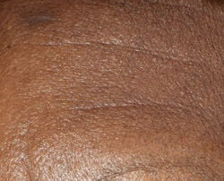 Photo before using Wrinkle Moisturizing Cream