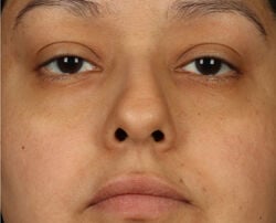 Photo after using pH Balance Replenishing Cream