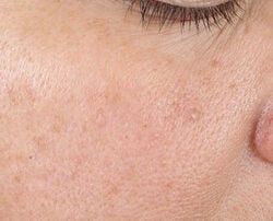 Photo after using Texture Renewal Serum