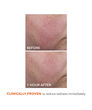Display Product Shot: Blur + Repair Moisturizer Cream with Hyaluronic Acid, Image 5 of 8
