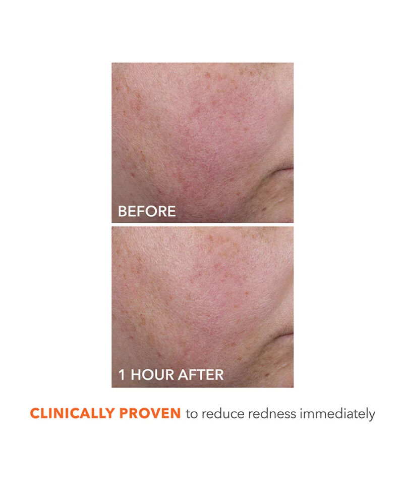 Blur + Repair Moisturizer Cream with Hyaluronic Acid, Image 5 of 8