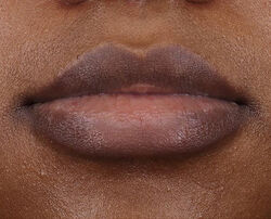 Photo after using LipWare Pro LED Device
