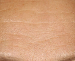 Photo after using 15% Vitamin C Firm & Bright Serum