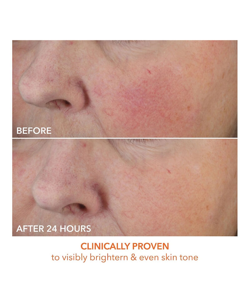Dewy Deep Cream, Image 6 of 8
