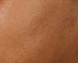 Photo after using Universal Daily Peel